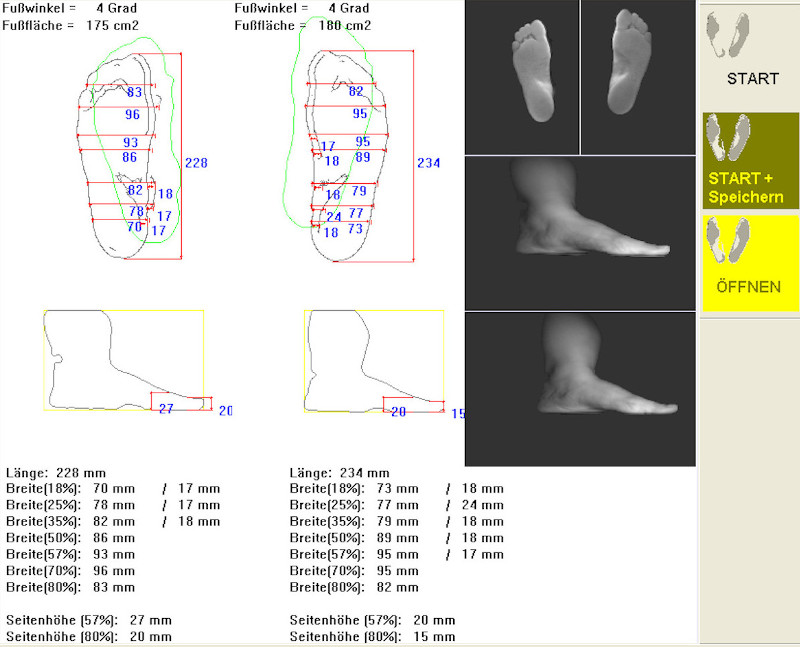 foot scanner